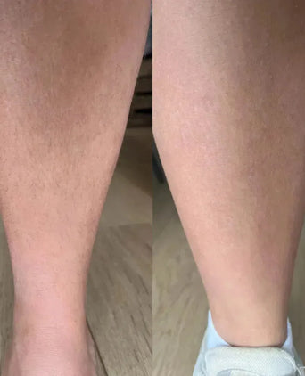 Keramene body hair minimizer ontharingscrème