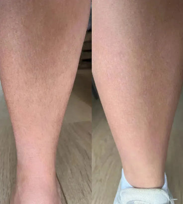 Keramene body hair minimizer ontharingscrème