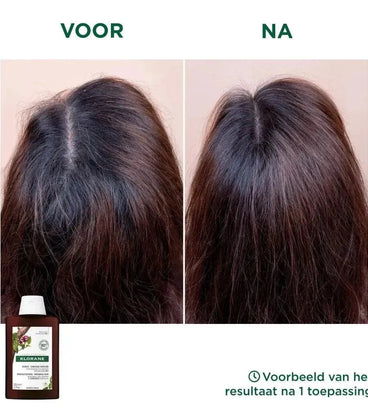 Klorane anti-haaruitval shampoo Kinine/Edelweiss (400 ml)