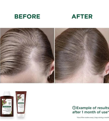 Klorane anti-haaruitval conditioner Kinine/Edelweiss (200 ml)
