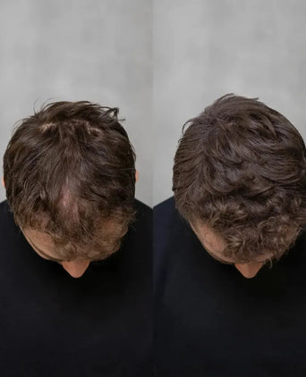 Keratain pommade + Keratain haarvezels
