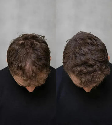 3x Keratain haarvezels + gratis Keratain pommade - Zwart (25 gr)