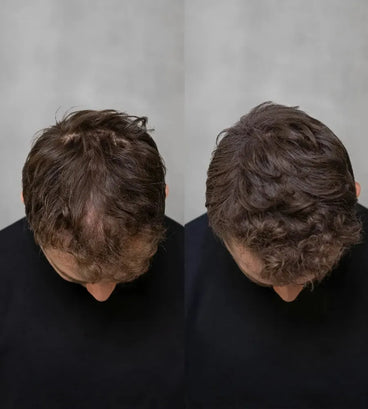 Keratain pommade + Keratain haarvezels - Zwart (25 gr)