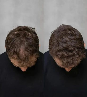 Keratain haarvezels - Donkerblond (25 gr)