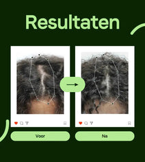 Scandinavian Biolabs Bio-Pilixin shampoo + conditioner vrouw (250 ml)
