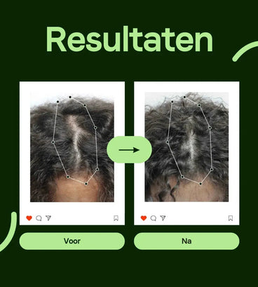Scandinavian Biolabs Bio-Pilixin shampoo + conditioner vrouw (250 ml)