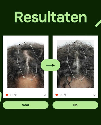 Scandinavian Biolabs Bio-Pilixin serum (vrouw)