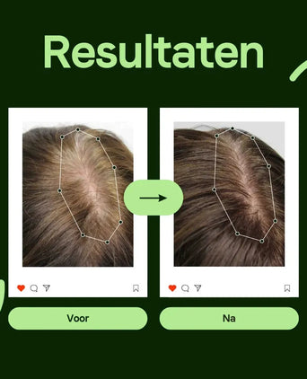 Scandinavian Biolabs Bio-Pilixin serum (vrouw)