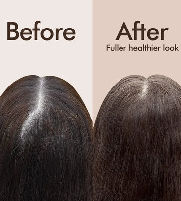 Beaver Biotin & Caffeine thickening scalp behandeling