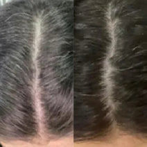 Neofollics anti-grey hair tablets