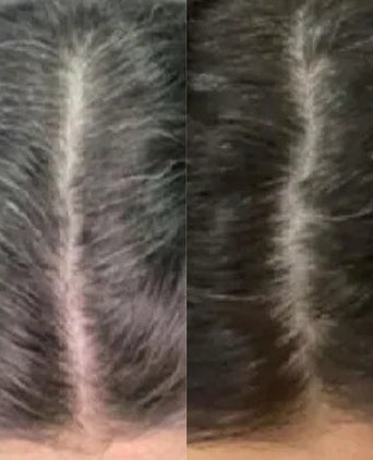 Neofollics anti-grey hair tablets