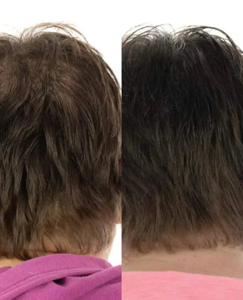 Foligain haaruitval shampoo + conditioner vrouw (236 ml)
