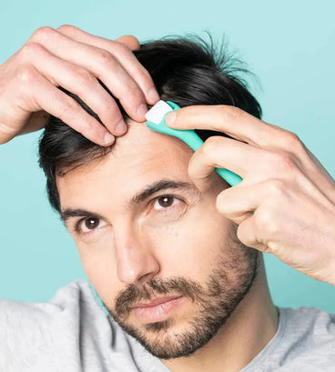 Neofollics scalp roller (0,3 mm)