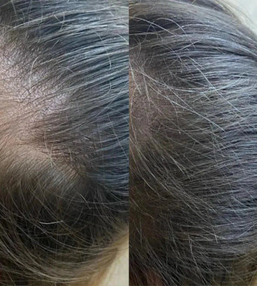 Panthrix haargroei serum (Redensyl)