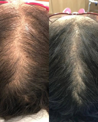 Revita haargroei shampoo + conditioner (925 ml)