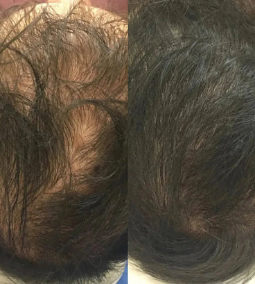 Revita haargroei shampoo + conditioner (205 ml)