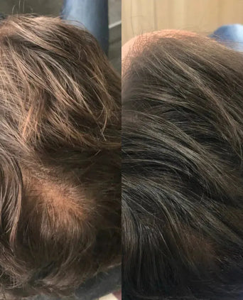 Revita haargroei shampoo + conditioner (205 ml)