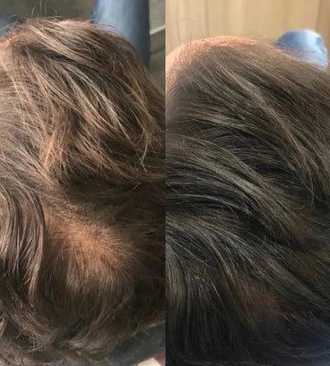 Revita haargroei shampoo + conditioner (205 ml)