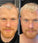 Scandinavian Biolabs haargroei behandeling (man)