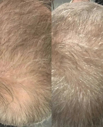 Scandinavian Biolabs Bio-Pilixin shampoo + conditioner man (250 ml)