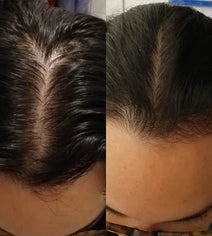 Scandinavian Biolabs haargroei behandeling (vrouw)