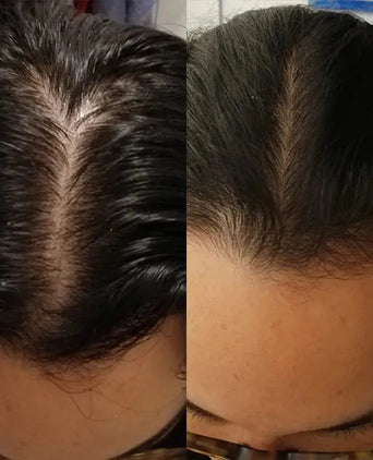 Scandinavian Biolabs haargroei behandeling (vrouw)