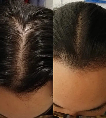 Scandinavian Biolabs Bio-Pilixin serum (vrouw)