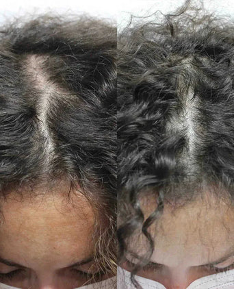 Scandinavian Biolabs haargroei behandeling (vrouw)