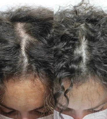 Scandinavian Biolabs haargroei behandeling (vrouw)