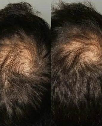 Viviscal hair growth supplement voor mannen (1 mnd)