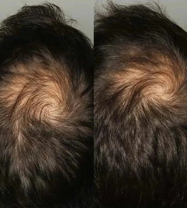 Viviscal hair growth supplement voor mannen (3 mnd)