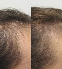 Viviscal hair growth supplement voor vrouwen (1 mnd)