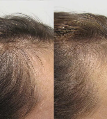Viviscal hair growth supplement voor vrouwen (1 mnd)
