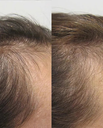 Viviscal hair growth supplement voor vrouwen (3 mnd)