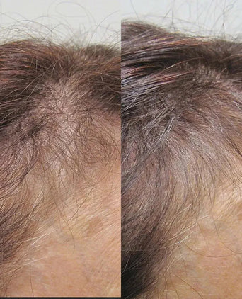 Viviscal hair growth supplement voor vrouwen (3 mnd)