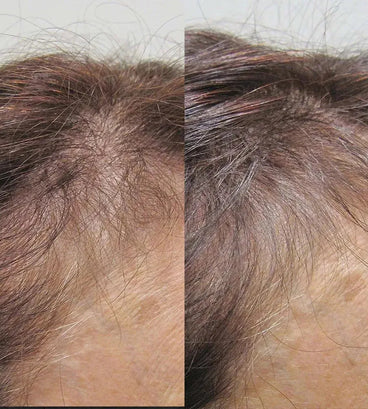 Viviscal hair growth supplement voor vrouwen (1 mnd)